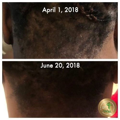 Hair Serum