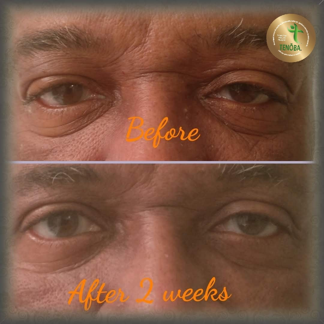 Eye Gel (all natural)