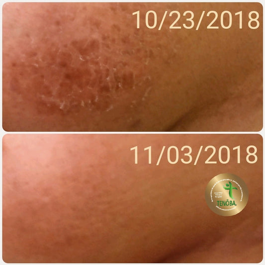 Skin Enhancing Serum (Dermatitis)