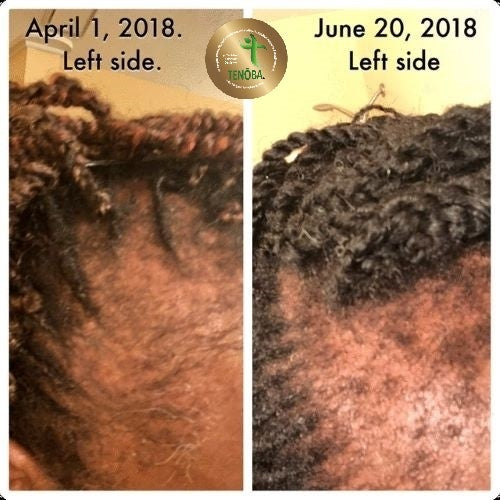Hair Serum