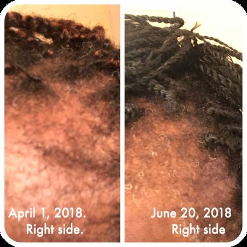 Hair Serum