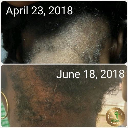 Hair Serum
