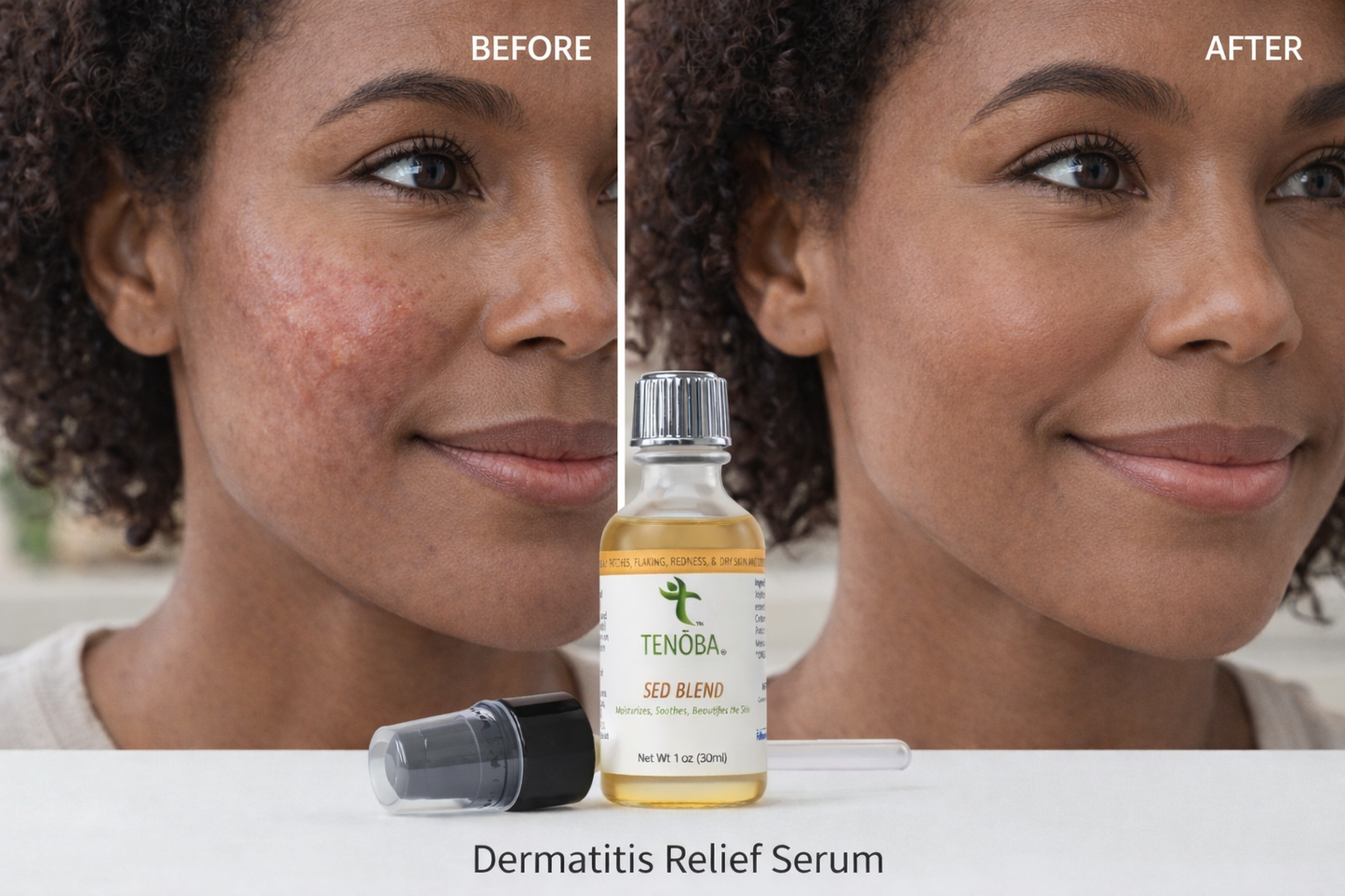 Skin Enhancing Serum (Dermatitis)