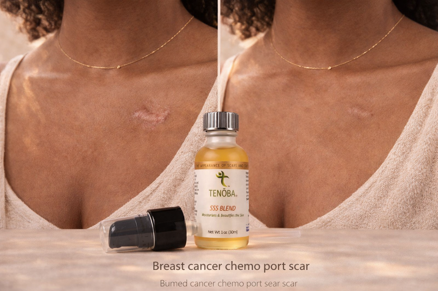 Skin Enhancing Serum (Scars Stretch Marks)